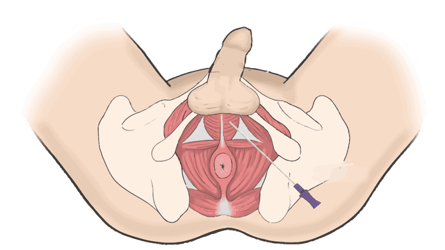 Анатомическая схема бульбокавернозной мышцы