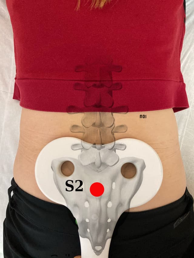 Трансвертебральная магнитная нейромодуляция